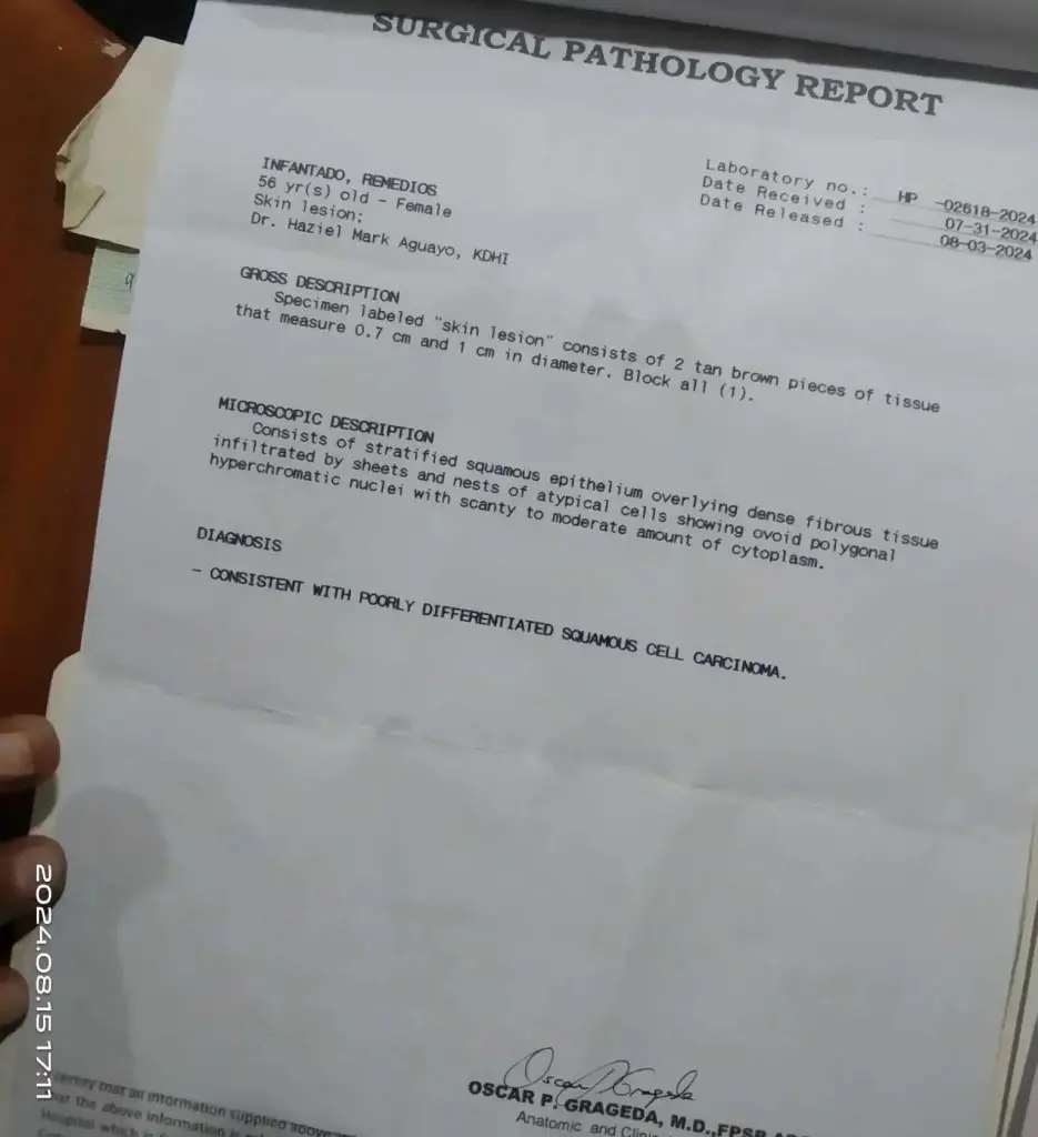 mama pathological report showing carcinoma